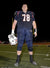 Football leads to concussions. Does running lead to 