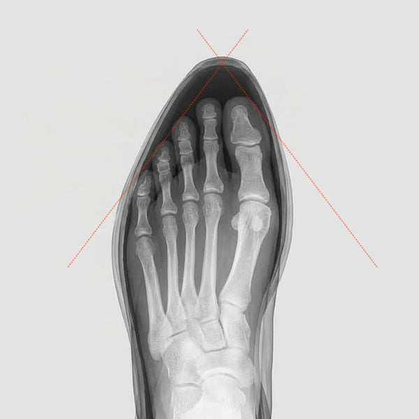 Illustration of narrow toe box squeezing toes together compared to natural foot shape